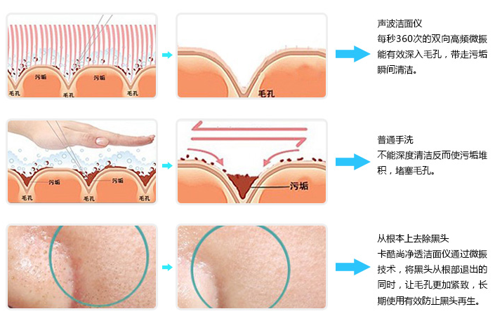 超音波美容仪的工作原理